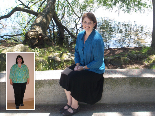 Laura, Before and After Bariatric Surgery