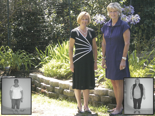 Dana and Susan, Before and After Bariatric Surgery