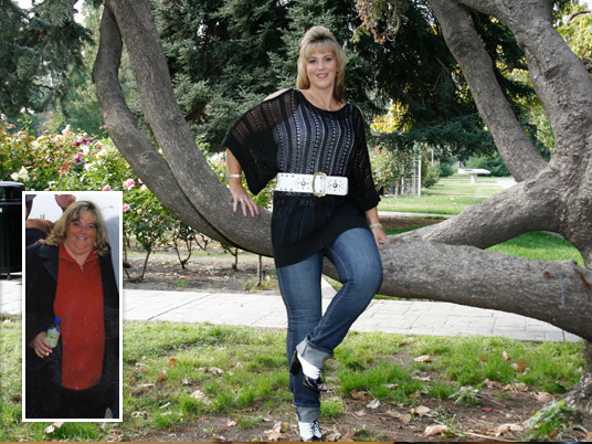 Colleen, Before and After Bariatric Surgery