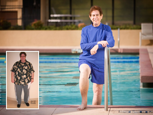 Gary S., Before and After Bariatric Surgery