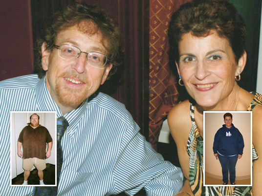 Ira and Jeanne, Before and After Bariatric Surgery