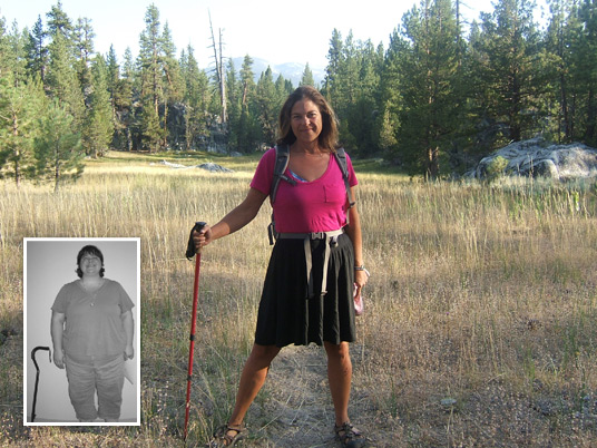 Jennifer, Before and After Bariatric Surgery