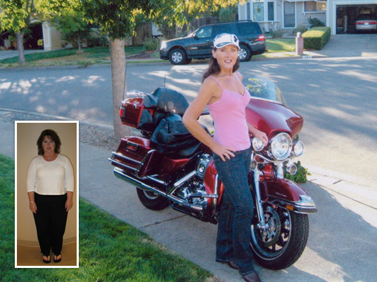 Martha, Before and After Bariatric Surgery
